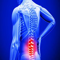 lower back pain symptoms